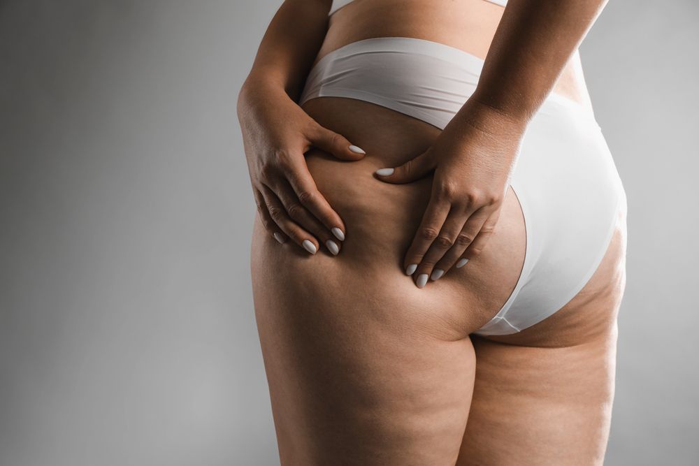Best Alternatives to Liposuction in Miami 2026